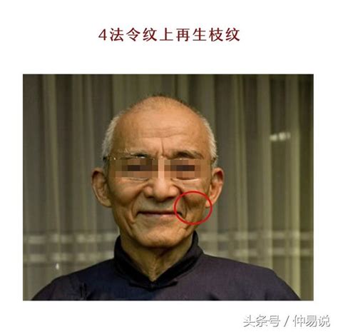 法令紋面相|面相：臉上4種法令紋，事業有成又長壽，你有哪一。